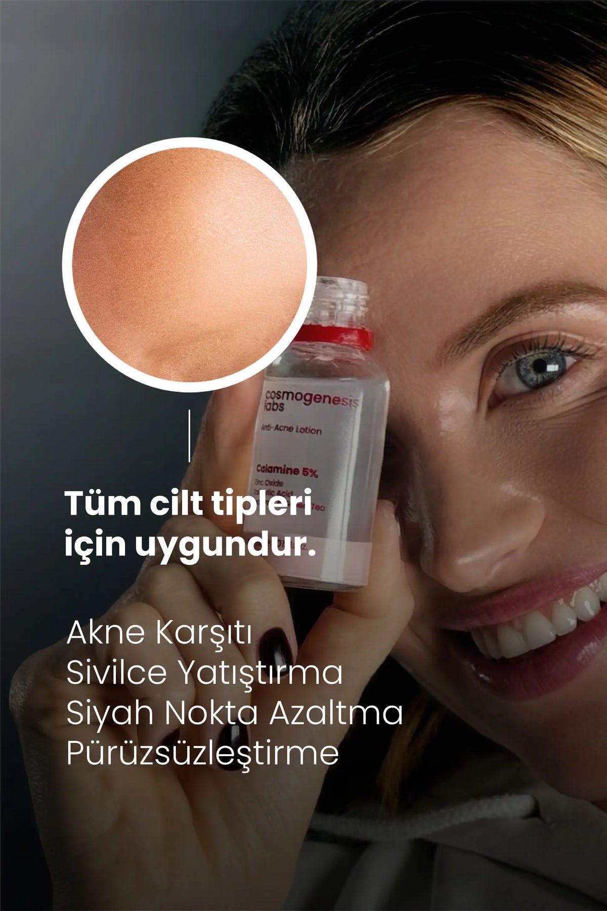 Akne Önleyici Kurutucu Losyon 30ml – Yatıştırıcı Siyah Nokta Azaltıcı Vegan (%5 Kalamin - Yeşil Çay)