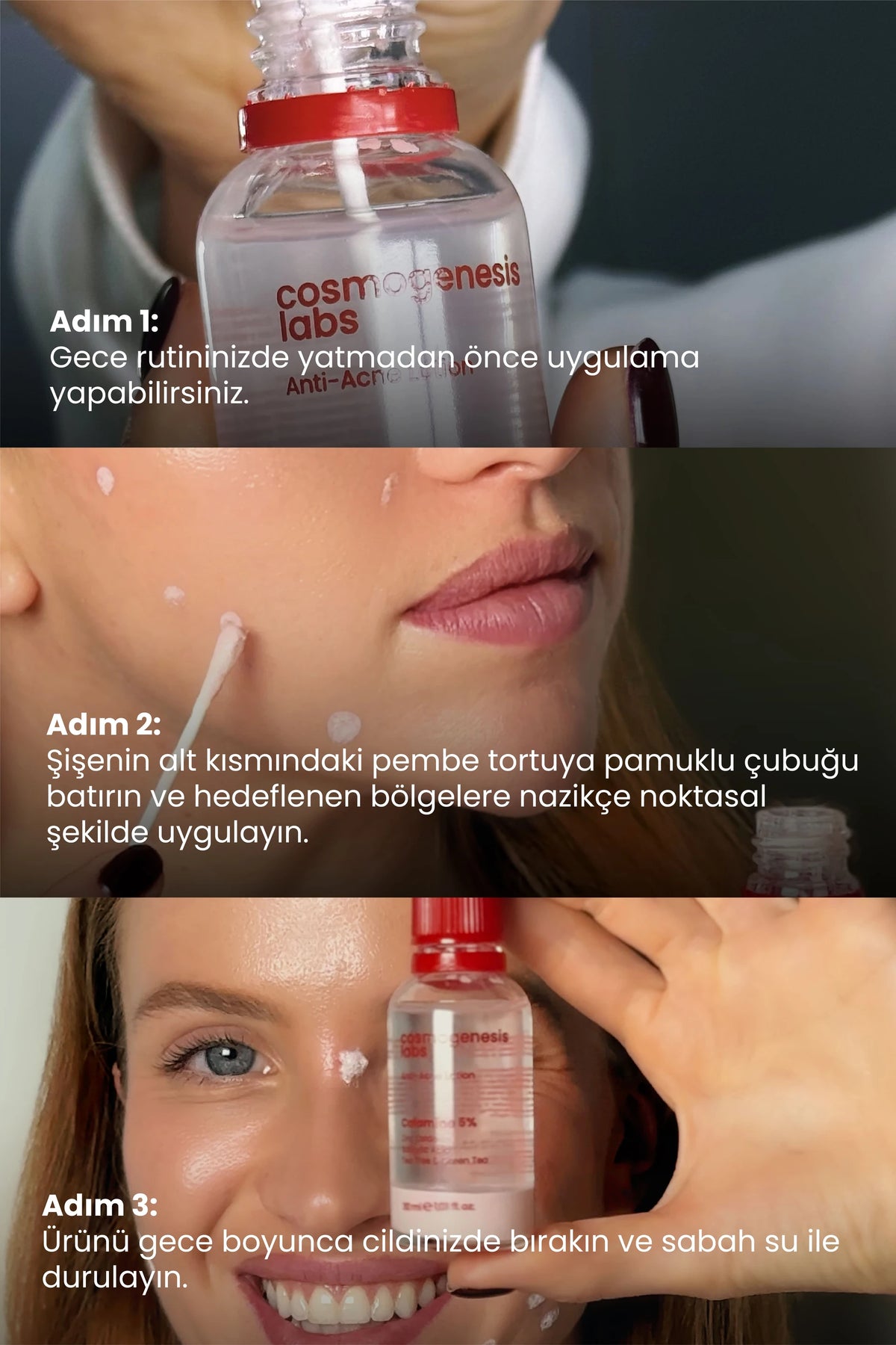 Akne Önleyici Kurutucu Losyon 30ml – Yatıştırıcı Siyah Nokta Azaltıcı Vegan (%5 Kalamin - Yeşil Çay)